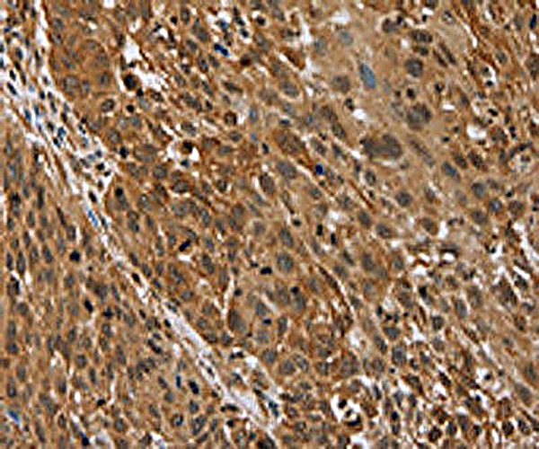 Custom Genieplex Multiplex Assay