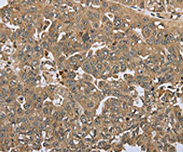 Human Custom Multiplex Assay