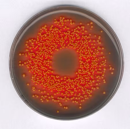 GranuCult prime Hektoen Enteric Agar de acordo com ISO 21567, FDA-BAM, de acordo com ISO 6579, selecione