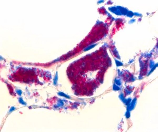 Solución de cloruro de hidrógeno en etanol, para el paquete de microscopia 1X1EA