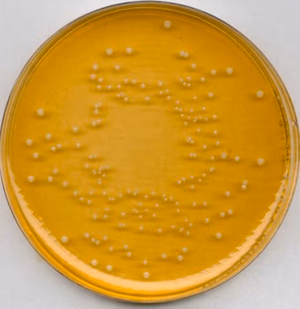 UNIVERSAL BEER AGAR FOR MICROBIOLOGY