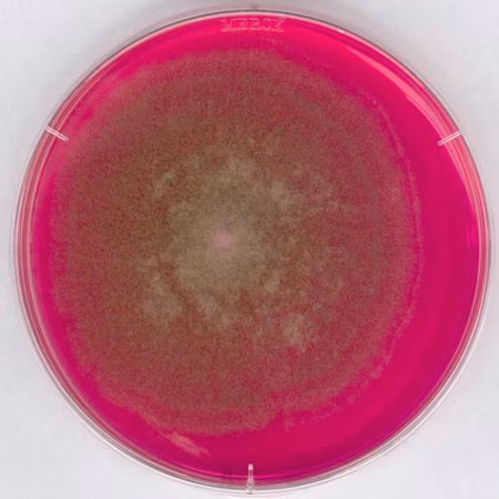 ROSE-BENGAL CHLORAMPHENICOL AGAR FOR MIC