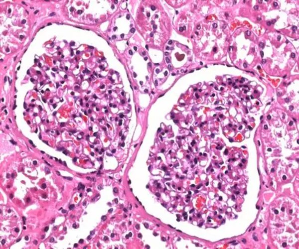 Solución de formaldehído 4%, amortiguada, pH 6.9 (aproximadamente 10% Solución formalina) para el paquete de histología 1X1EA