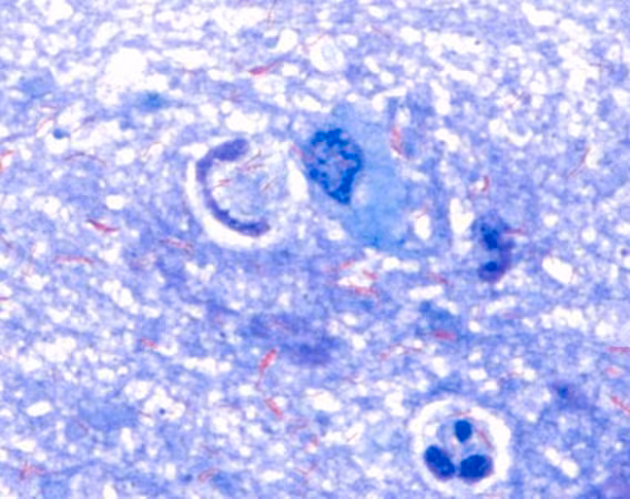 Löffler s solución azul metilen para el paquete de microscopía 1X1EA