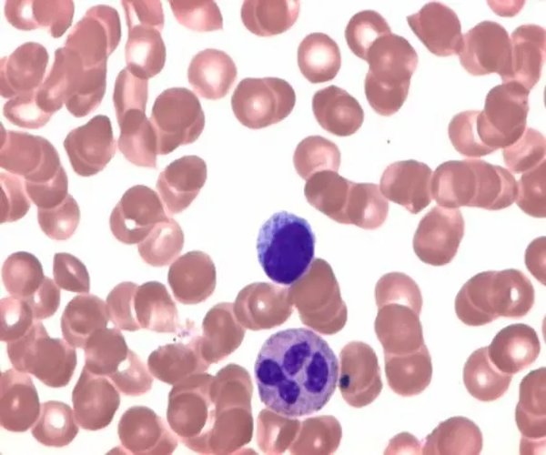 Leishman es azul eosino de metileno para microscopía 1X1EA