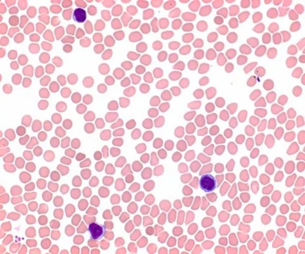 May-Grünwald's eosin metileno azul para microscopía pack 1X1EA