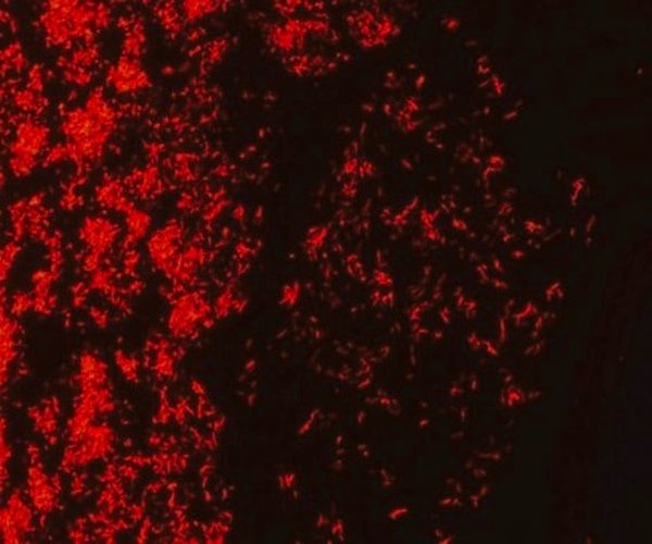 AFB-Fluor phenol-free Kit de retención para el examen de bacterias ácido-rápido con micro fluorescencia