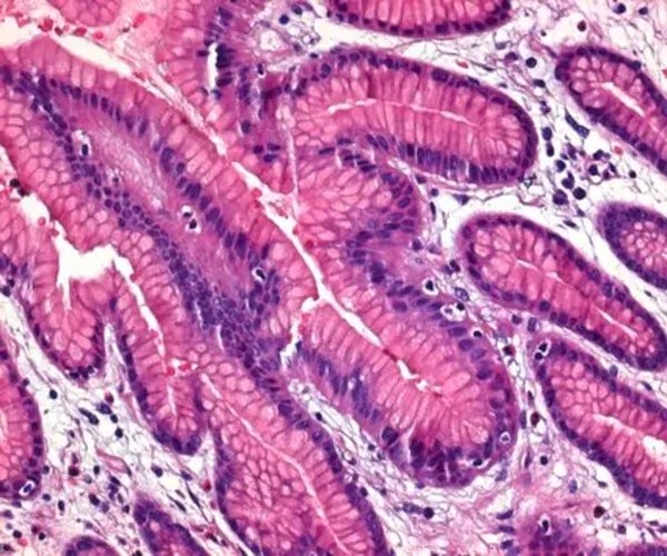Solución de formaldehído min. 37% libre de ácido estabilizado con cerca de 10% de metanol y carbono de calcioa