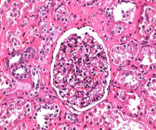 Solución de hematoxilina modificada acc. a Gill III para el paquete de microscopia 1X1EA