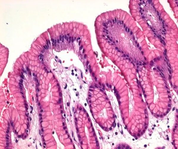Solución de hematoxilina modificada acc. a Gill II para el paquete de microscopia 1X1EA