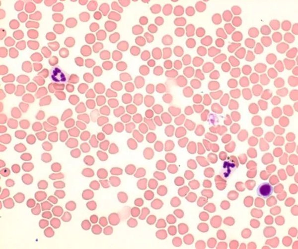 Giemsa's azur eosin solución azul metileno para microscopía paquete 1X1EA