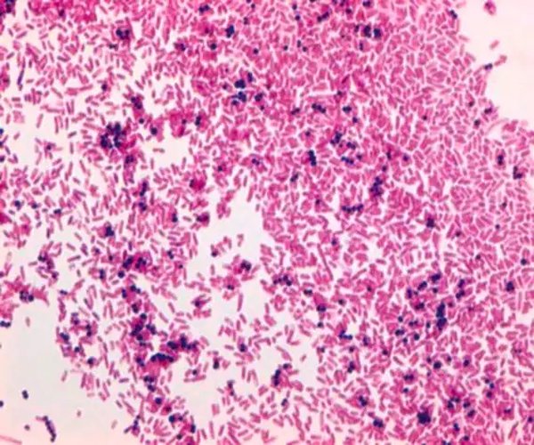 Solución safranina de gramos para el paquete de método de manchas Gram 1X1EA