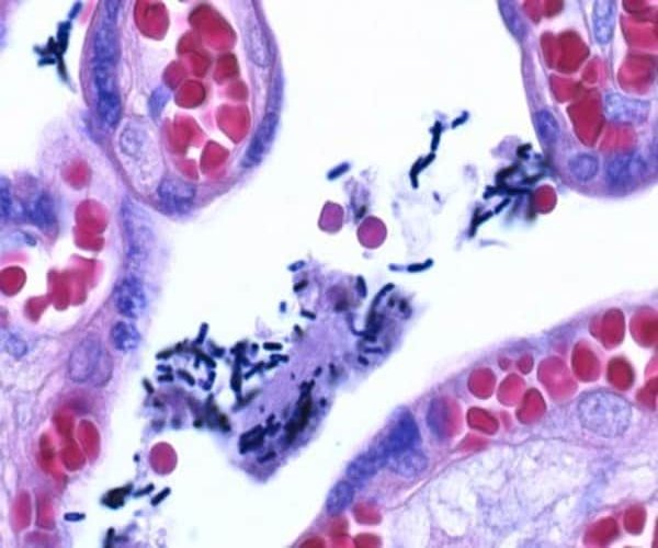 Solución violeta de Gram para el paquete de método de tinción Gram 1X1EA