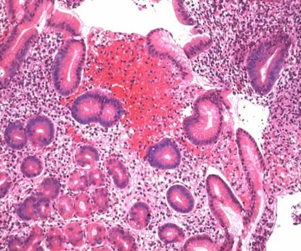 Mayer s solución hemalum para el paquete de microscopía 1X1EA