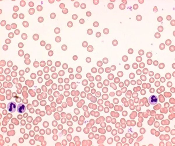Tintura rápida de hemacolor de mancha de sangre adecuada para la hematología, conjunto de manchas para la microscopía