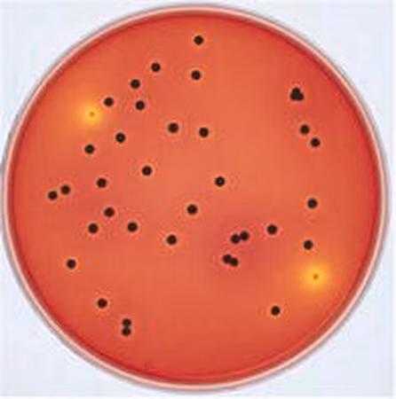 AGAR XLT4 (BASE) PARA MICROBIOLOGÍA ( 59 G