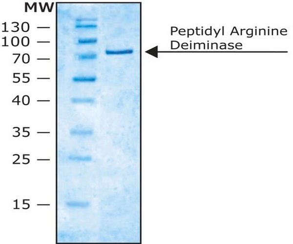 PEPTIDIL ARGININA DEIMINASA pack 1X25UN
