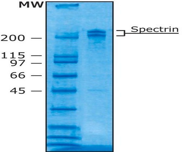 ESPECTRINA DE ERITROCITOS HUMANOS pack 1X50UG
