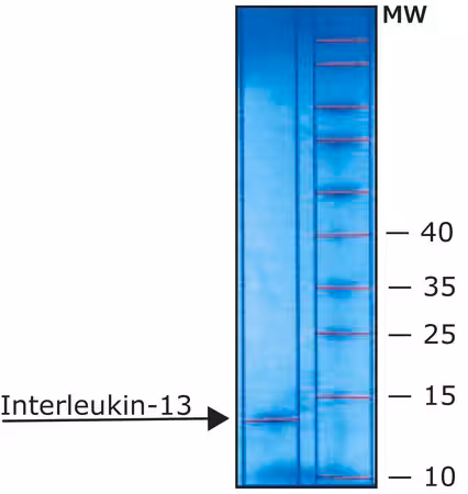 INTERLEUCINA-13 RECOMBINANTE HUMANA pack 1X10UG