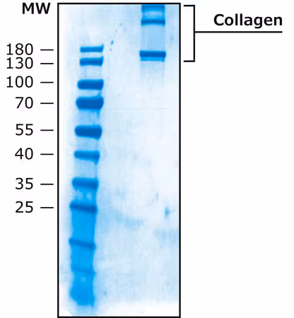 COLÁGENO TIPO X, SOLUBLE EN ÁCIDO HUMANO pack 1X1MG