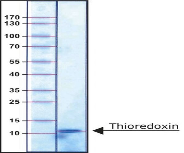 TIOREDOXINA, E. COLI, RECOMBINANTE EXPRES pack 1X1MG