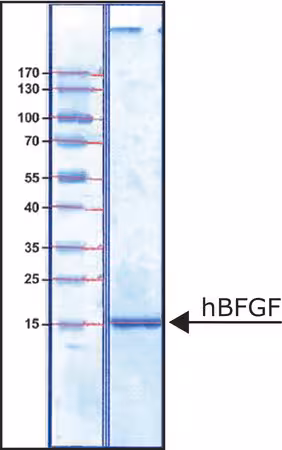 FIBROBLAST GROWTH FACTOR-BASIC HUMAN& pack 1X25UG