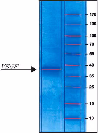 VASCULAR ENDOTHELIAL GROWTH FACTOR& pack 1X10UG