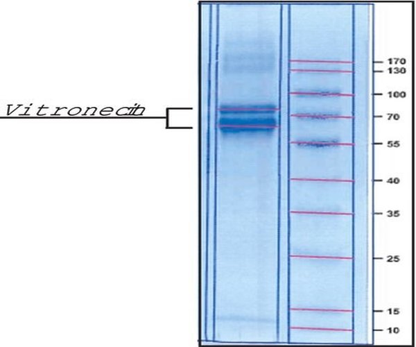 VITRONECTIN FROM FROM HUMAN PLASMA LYOP& pack 1X50UG