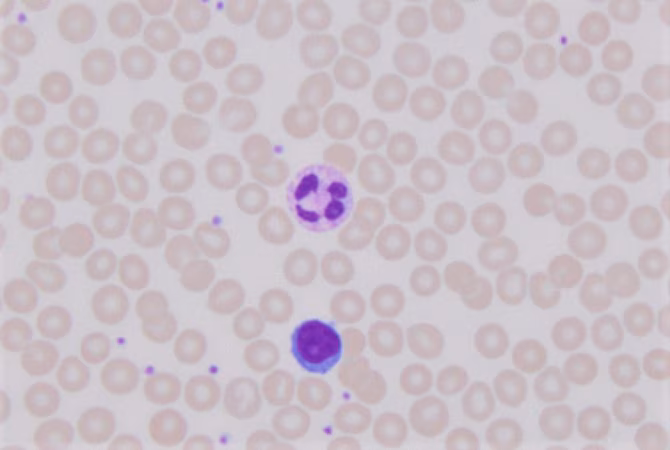 GIEMSA STAIN, MODIFIED pack 1X500ML