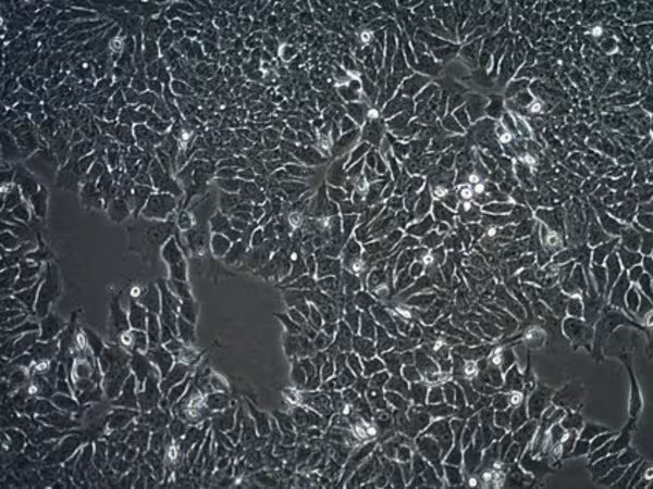 MCF-7/TAMR-1 Human Breast Cancer Cel pack 1X1EA