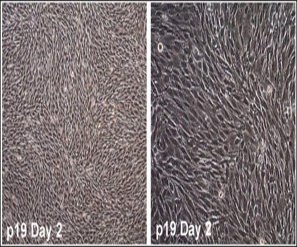 Mouse Cranial Neural Crest Cell Line O9- pack 1X1EA