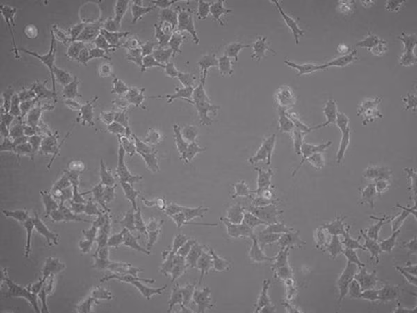 LOX-IMVI HUMANO MELANOMA CELL LINE pack 1X1EA