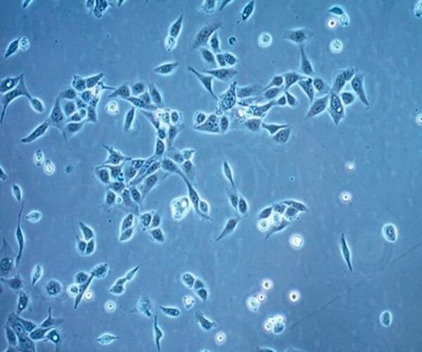 OECM-1 SQUAMOUS CARCINOMA CELL LINE pack 1X1EA