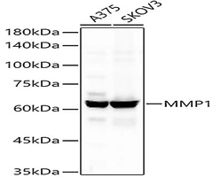 MMP1 Monoclonal Antibody, 20µl - Assay Genie - Anticuerpos primarios