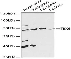 TBX6 Rabbit Polyclonal Antibody, 20µl - Assay Genie - Anticuerpos primarios