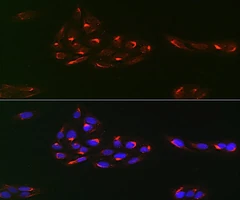 PDGFRA Rabbit Polyclonal Antibody. 20µl - Assay Genie - Anticuerpos primarios
