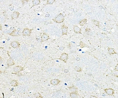 GIPR Rabbit Polyclonal Antibody - 20uL - Assay Genie - Anticuerpos primarios