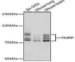 FMRP Rabbit Monoclonal Antibody (CAB4539)  - Assay Genie - Anticuerpos primarios
