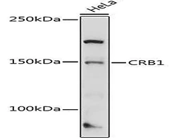 CRB1 Rabbit Polyclonal Antibody, 20 ul - Assay Genie - Anticuerpos primarios