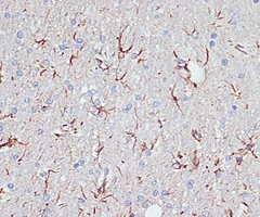 GFAP Rabbit Polyclonal Antibody (CAB14673), 100µL - Assay Genie - Anticuerpos primarios