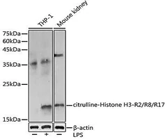 citrulline-Histone H3-R2/R8/R17 Rabbit Polyclonal Antibody (CAB18298), 20μL - Assay Genie - Anticuerpos primarios