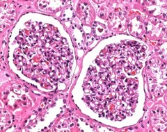Solución de formaldehído al 4%, tamponada, pH 6,9 (aprox. solución de formalina al 10%) para histolo - Sigma Aldrich - Fijadores de tejidos