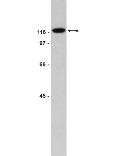 Anti-FAK Antibody, clone 4.47 200 μG - Sigma Aldrich - Anticuerpos primarios - Anticuerpos - 05-537-1