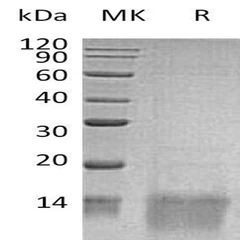 Human ADAM10 Recombinant Protein (RPPB2700)-10µg - Assay Genie - Anticuerpos primarios - Anticuerpos - RPPB2700-0