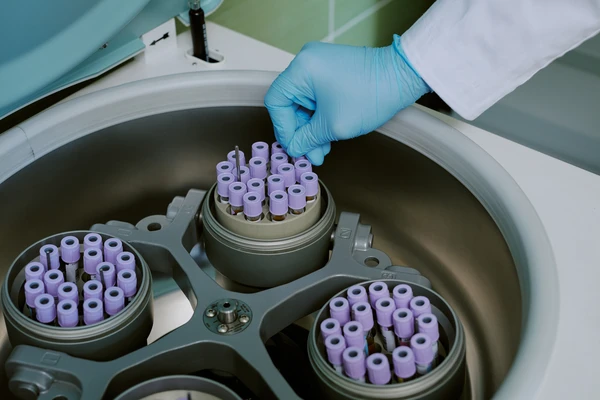 Guía Práctica: Cómo elegir la centrífuga ideal según tu aplicación