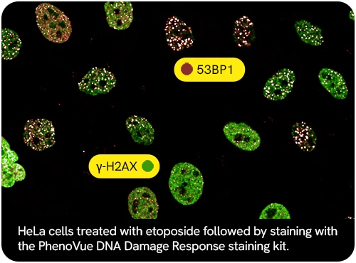 Cómo mejorar la imagen celular en el laboratorio: guía con PhenoVue™