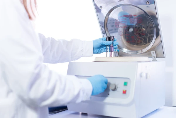 Guía completa para elegir el mejor agitador orbital para tu laboratorio