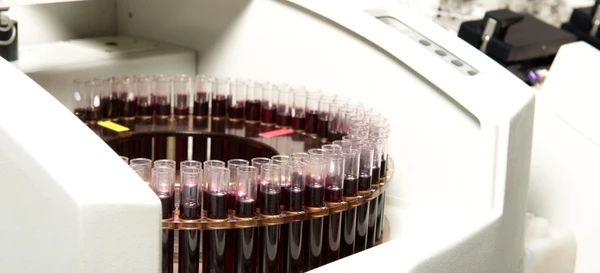 Sinergias enológicas: Vinificación con no-Saccharomyces y su control mediante analítica de precisión