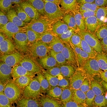 Cómo estudiar el daño en el ADN: descubre el PhenoVue™ DNA Damage Response Staining Kit