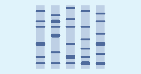 Protein electrophoresis